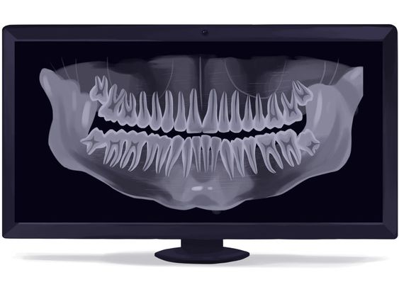 dental radiology